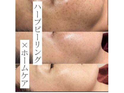 ラニウル(Laniulu)の写真