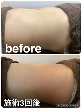 ギンザアール(GINZA R.)/ぽっこりお腹に徹底アプローチ◎