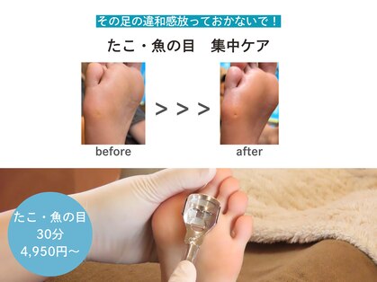 ドクターネイル爪革命 札幌本店の写真