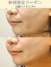 【理想のフェイスラインに!】筋膜から引き上げる小顔バイオリフト9980円