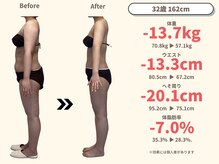 ニドム/32歳　-13kg痩身ダイエット2