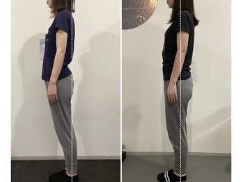 ナナ 札幌店(NANA)の写真/反り腰・猫背改善！骨格から整えて見た目も不調も変わる!?