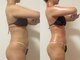 エパニ(epani)の写真/「何をしても体型が変わらなかった…」そんなお悩みの方におすすめ！短期間で叶える本格サイズダウン。