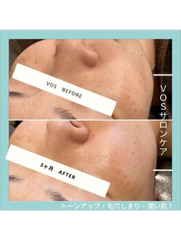 ジュネラ ボーテ(Jenela beaute)/VOSサロンケア