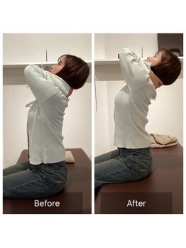 ことほぎ鍼灸整体 奈良登美ヶ丘院/全身整体で動きの変化☆