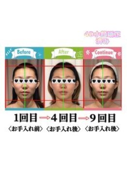 小顔整体研究所 KSラボ 新潟中山店/