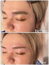 アカヌケ(AKANUKE)/メンズ美眉WAX脱毛