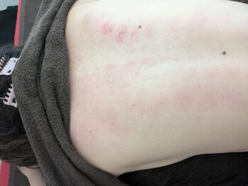 リデザイン 京都(REDESIGN)/REDESIGN京都中医施術法