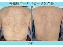 リメイククリニカルビューティー(Remake clinical beauty)/