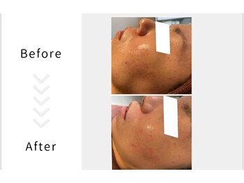 レガリア(LEGAREA)/