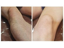 クレア 新小岩店(CREA)/ひざ上下