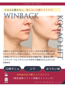 メイクス(Makes)の写真/【持続力に自信】高周波多層アプローチで頭皮からリフトアップ！深層タイトニングでたるみを徹底ケア◎