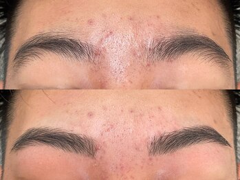 アンベリール みなとみらい店(Embellir)/眉毛ワックスbeforeafter