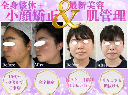 ノア 新宿(Noa)の写真