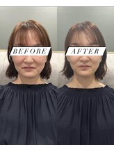 シロ(silo.)/世界最高峰美顔器メデューサ