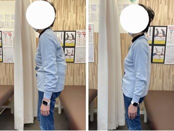 ナオル整体 札幌院(NAORU整体)/札幌円山/整体/姿勢矯正/猫背