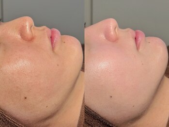 ルーナジェーナ(Luna llena)/池袋/目白/雑司ヶ谷/エステ