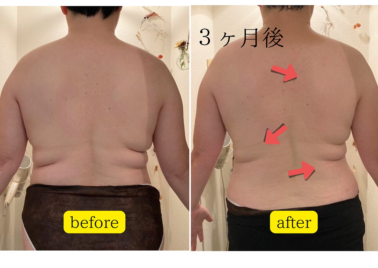 ヨサパーク パーチェ(YOSA Pace)｜ホットペッパービューティー