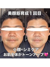 リエル(RIEL)/【美顔筋育成】