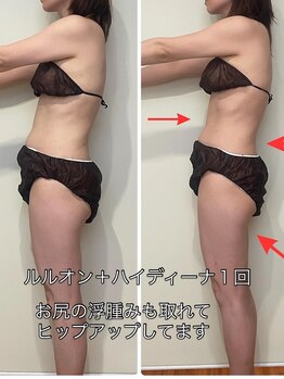 ヨサパーク シピ(YOSAOARK Chipie)/ルルオン1回の効果