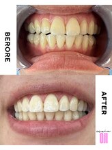 エクシアホワイトニング 王寺店/