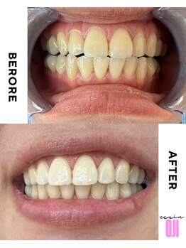 エクシアホワイトニング 王寺店/