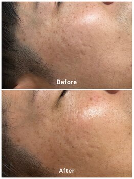 エビスラボ(Ebisu Labo)/メンズの方もお肌をキレイに