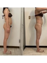 ベル(belle)/お腹before after