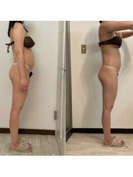 ベル(belle)/お腹before after