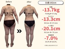 ニドム/32歳　-13kg痩身ダイエット3