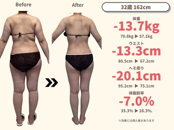 ニドム/32歳　-13kg痩身ダイエット3