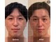グレースフィオーレ モラージュ柏店(gracefiore)の写真/《柏駅3分隠れ家プライベートサロン》第一印象は顔で決まる。男のための本格小顔矯正13,000円⇒6,200円