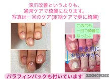 ネイルセラピーサロン プラムジュース(Nail Therapy Salon Plum Juice)