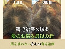 ハリング(HARIING)