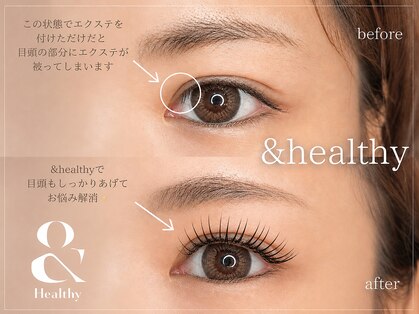 ルシアル(Rucial)の写真