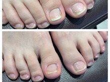 ウノプリール 梅田HARBIS PLAZA(uno pulir)/【フットネイルケア】