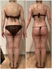 ◆痩身マシン◆脂肪層に直撃！最強痩身☆