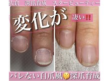 スターネイル(Starnail)の雰囲気（平爪丸い爪変化が◎3ヶ月集中ケア→ジェル育成で美爪美人に）
