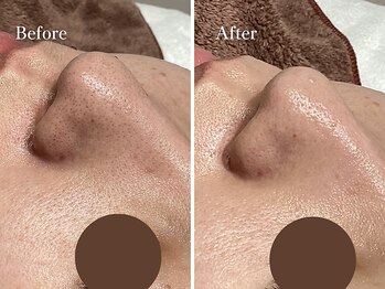 エリー(Ellie)/見た目の印象が大きく変わります