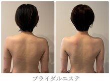 アロラヴィ(AroRavi)/ブライダルエステ