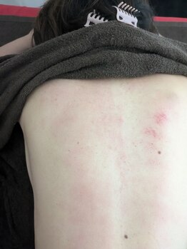 リデザイン 京都(REDESIGN)/REDESIGN京都中医施術法