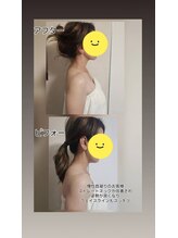 スマイリー(smiley)/首のお悩みありませんか？