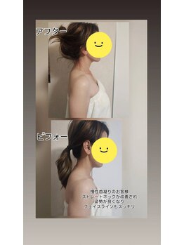 スマイリー(smiley)/首のお悩みありませんか?