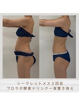 クロシェット(Clochette)/