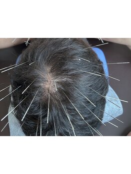 スゴ腕の施術者がいるサロン