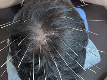 ふじた鍼灸整体院