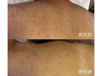 クリスタルビューティ 渋谷/【セラピールボディ】