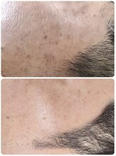 ル クラージュ(Le courage)/光フォト(40代男性)