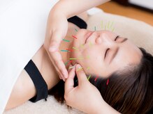 ティアラ(TIARA)/美容鍼