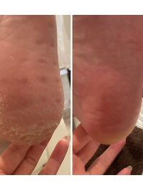 足裏、かかと集中ケアコース